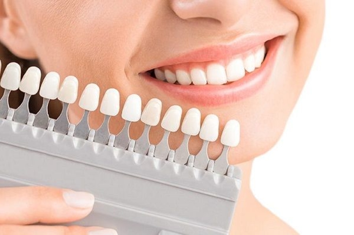 Các loại răng sứ đều có chất liệu lành tính, an toàn với cơ thể