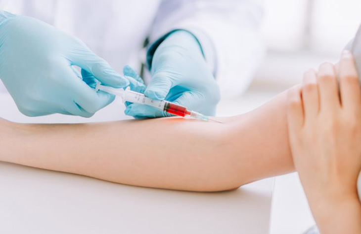 Khi kiểm tra sức khỏe, chúng ta dễ dàng bắt gặp ký hiệu PDW trong xét nghiệm máu