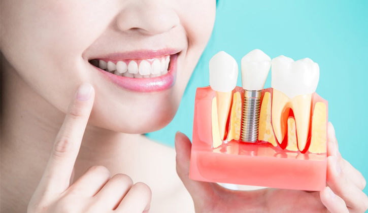 Trồng răng Implant là dịch vụ nha khoa an toàn