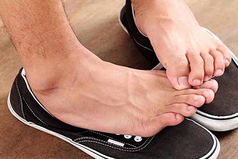 Ngón chân xoay vào bên trong thường xảy ra ở những người bị xoắn khớp gối