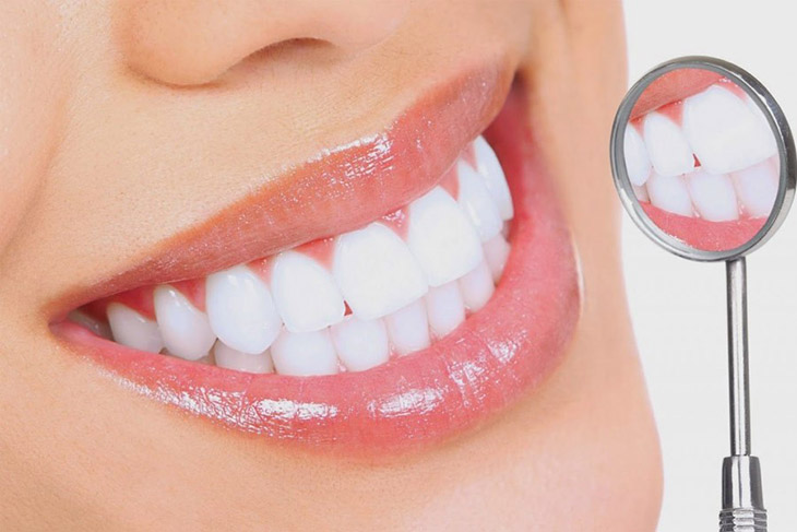 Giá bọc răng sứ còn phụ thuộc vào nhiều yếu tố khác nhau