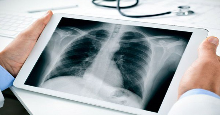 Chụp x-quang là một loại xét nghiệm hình ảnh y khoa, dùng để chẩn đoán rất nhiều bệnh lý