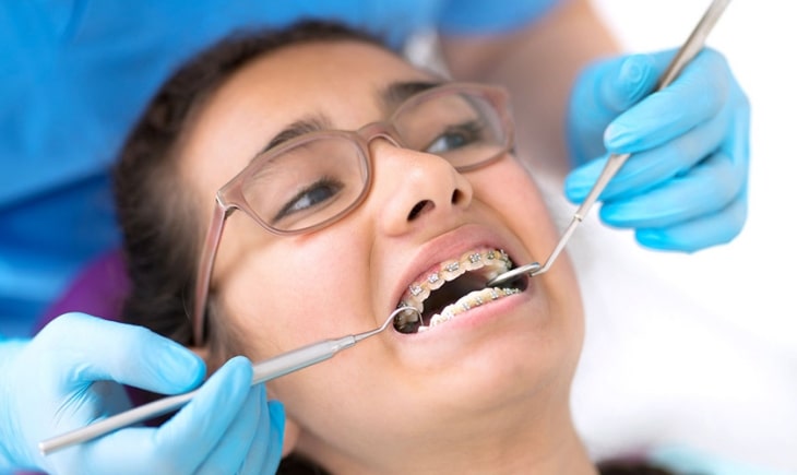 Các bác sĩ nha khoa khuyên nên niềng răng cho tới năm 50 tuổi