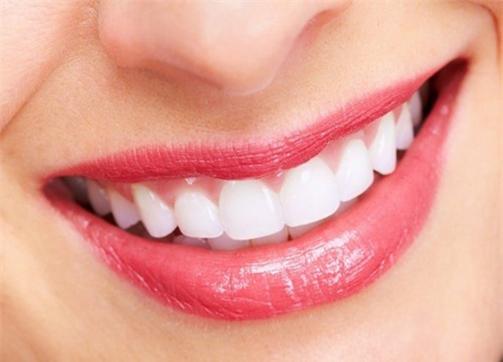Nên kiểm tra sức khỏe răng miệng thường xuyên