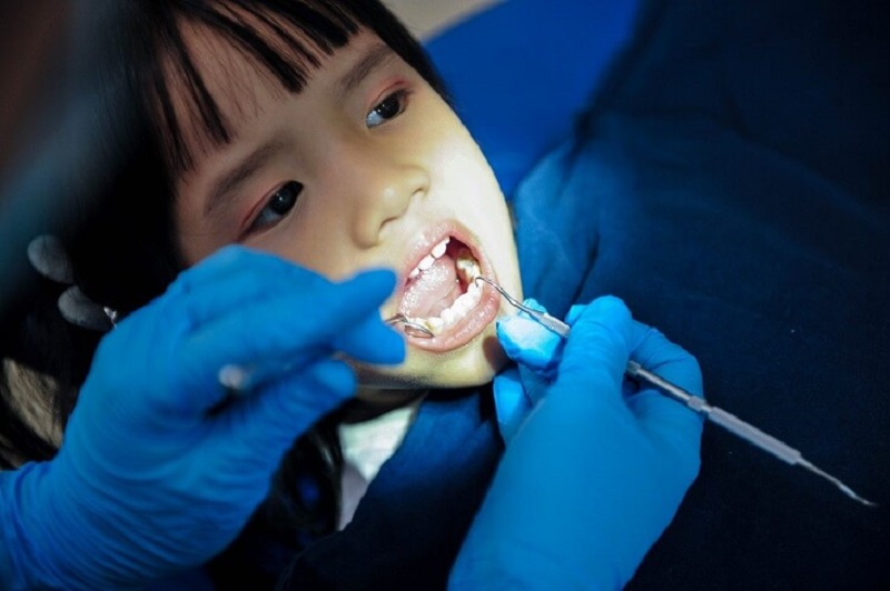 Độ tuổi được coi là thời điểm vàng cho việc niềng răng đó là từ 10 đến 14 tuổi