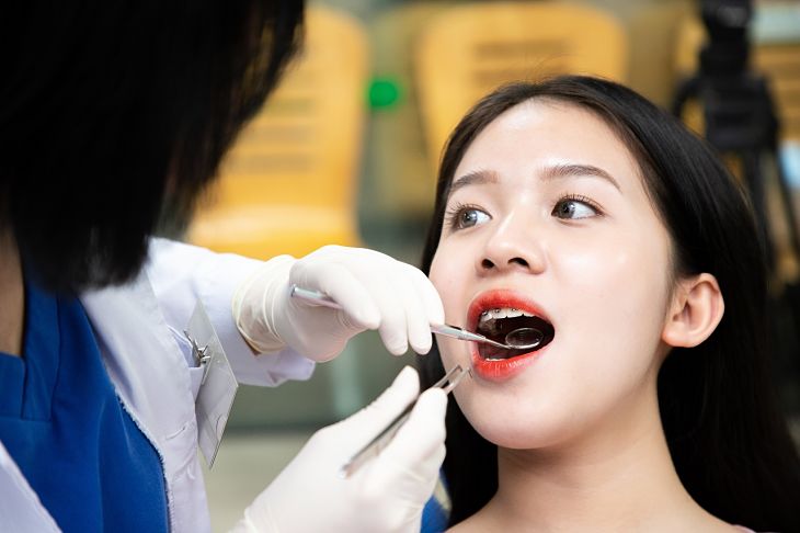 Quá trình niềng răng hô phải trả qua đầy đủ các bước từ khám răng đến gắn mắc cài