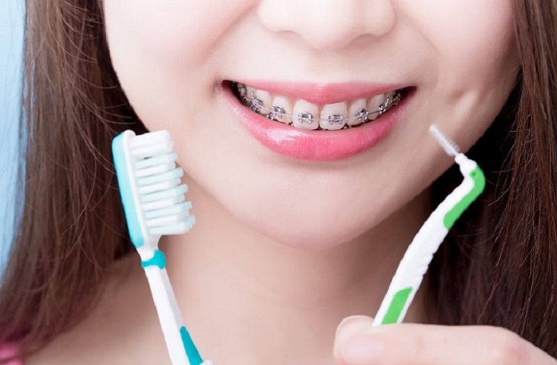 Chăm sóc răng miệng tỉ mỉ, chu đáo mỗi ngày là cách tốt nhất để răng nhanh ổn định, đều đẹp hơn
