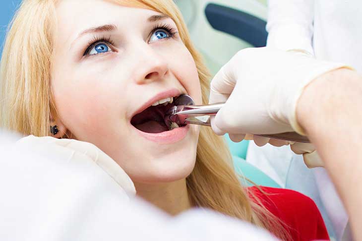 Nhổ răng số 5 không quá nguy hiểm nếu được thực hiện bởi những bác sĩ có tay nghề cao