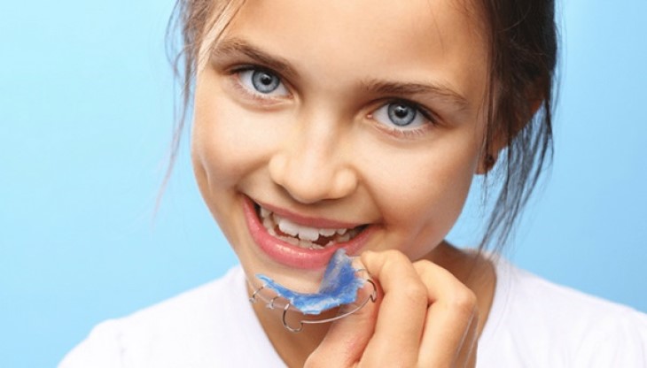 Hàm trainer có nhiều ưu điểm nổi bật trong việc niềng răng cho trẻ
