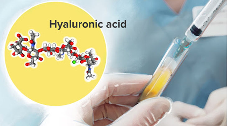 Acid Hyaluronic được sản xuất dựa trên chất nhờn tự nhiên có trong ổ khớp