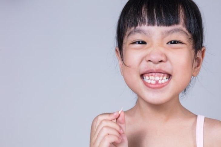 Trẻ em nên niềng răng sớm để đạt hiệu quả phục hình cao hơn