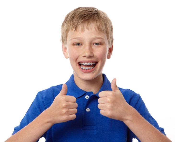Trẻ bao nhiêu tuổi thì niềng răng được? 10 - 16 tuổi là lứa tuổi "vàng" để niềng răng