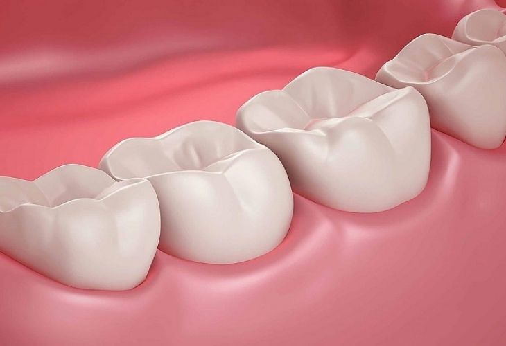 Trồng răng hàm là cách phục hình lại răng ở vị trí răng số 6 và 7
