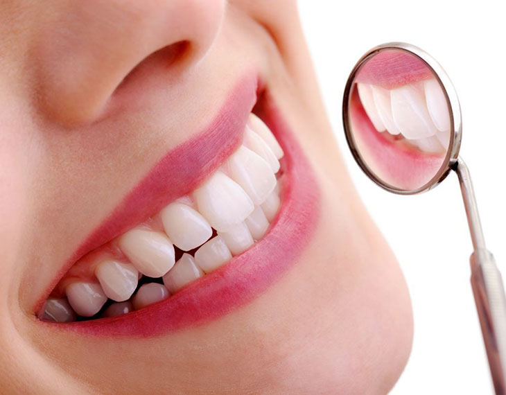 Chăm sóc răng miệng sau khi trồng răng sứ vô cùng cần thiết